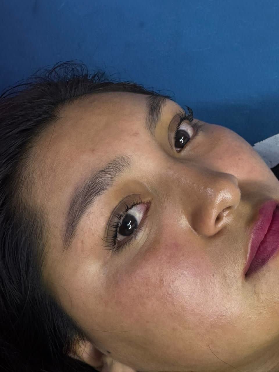 Clienta tras limpieza facial